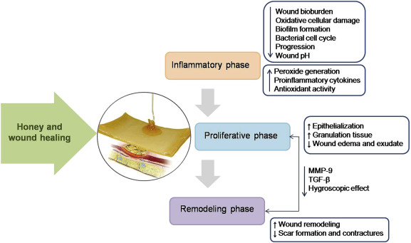 honey Fastens Wound Healing