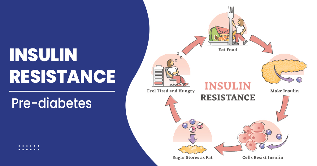 Insulin resistance