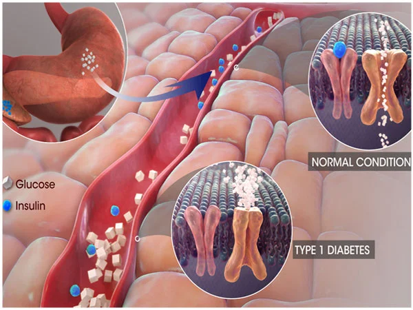  Let’s get to know what Insulin does to our Body