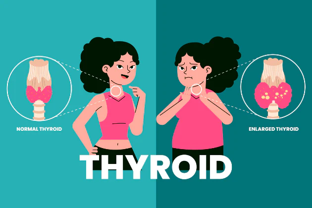 Healthy thyroid gland vs. thyroid disorders