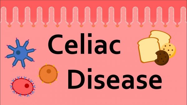 Celiac disease