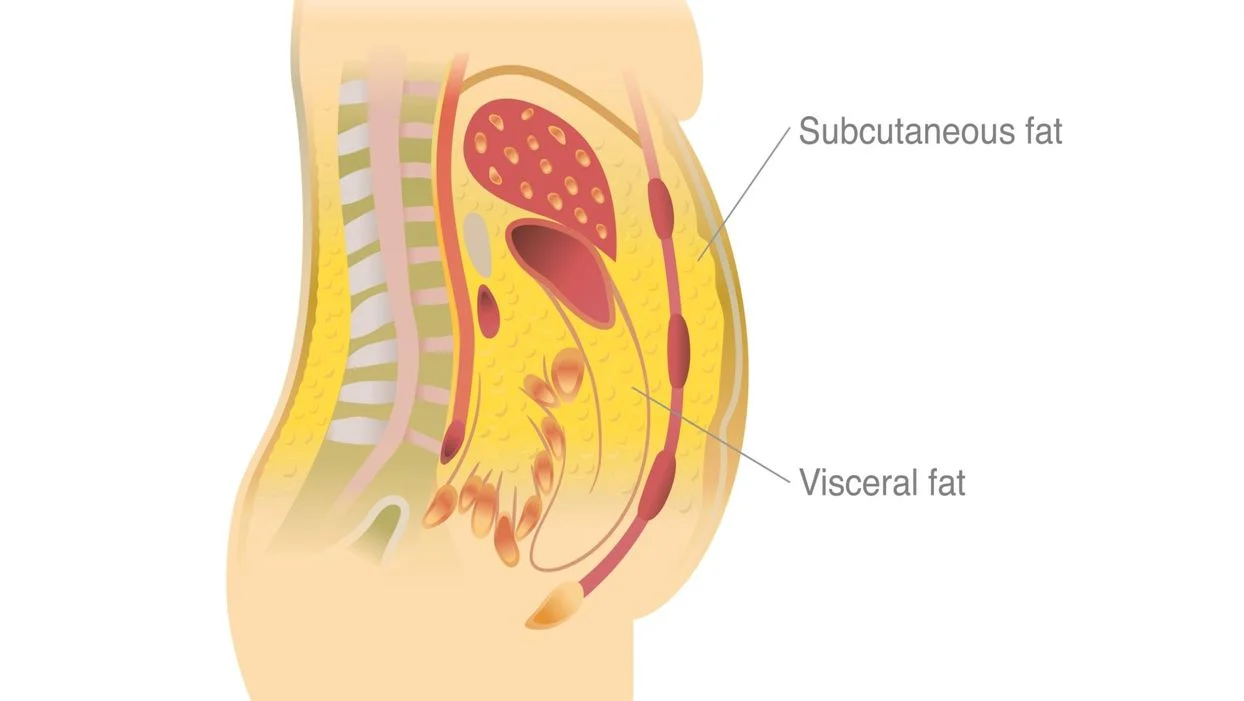 visceral fat