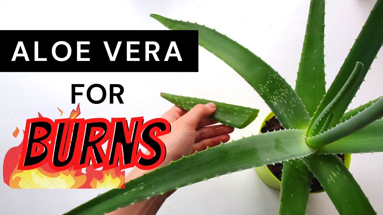 aloe vera heals burns