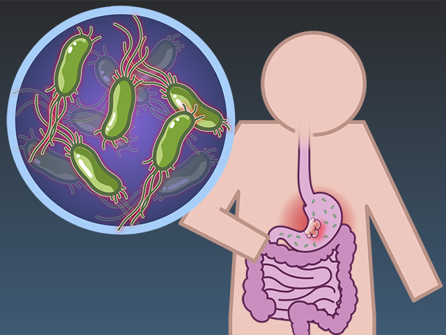 H.Pylori Treatment