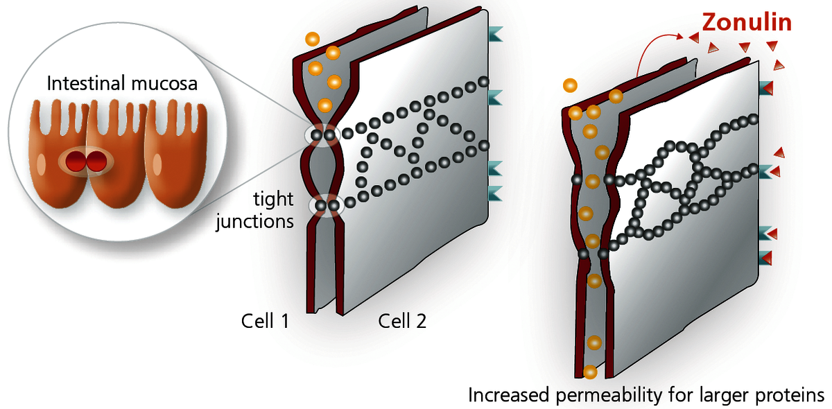 leaky gut junction